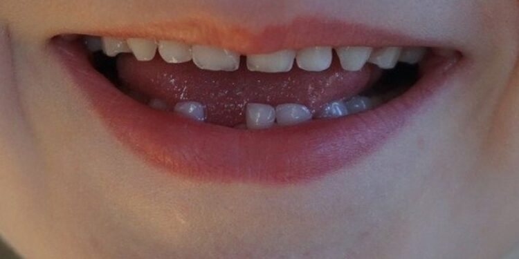 Odontopediatra fala sobre os cuidados com a saúde bucal de crianças e adolescentes