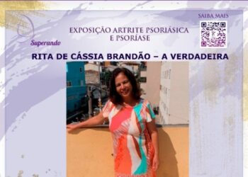 Estação recebe exposição informativa sobre psoríase e artrite psoriásica