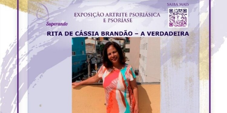 Estação recebe exposição informativa sobre psoríase e artrite psoriásica