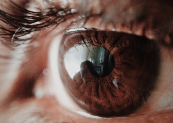 Doença do olho moema sp